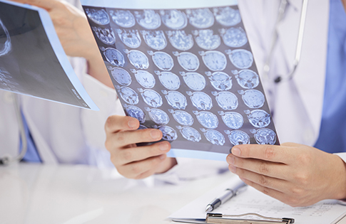 Enhance the sharpness of pathological images in medical film